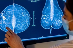 谷歌将乳腺癌筛查AI 研究模型授权给医疗技术公司iCAD